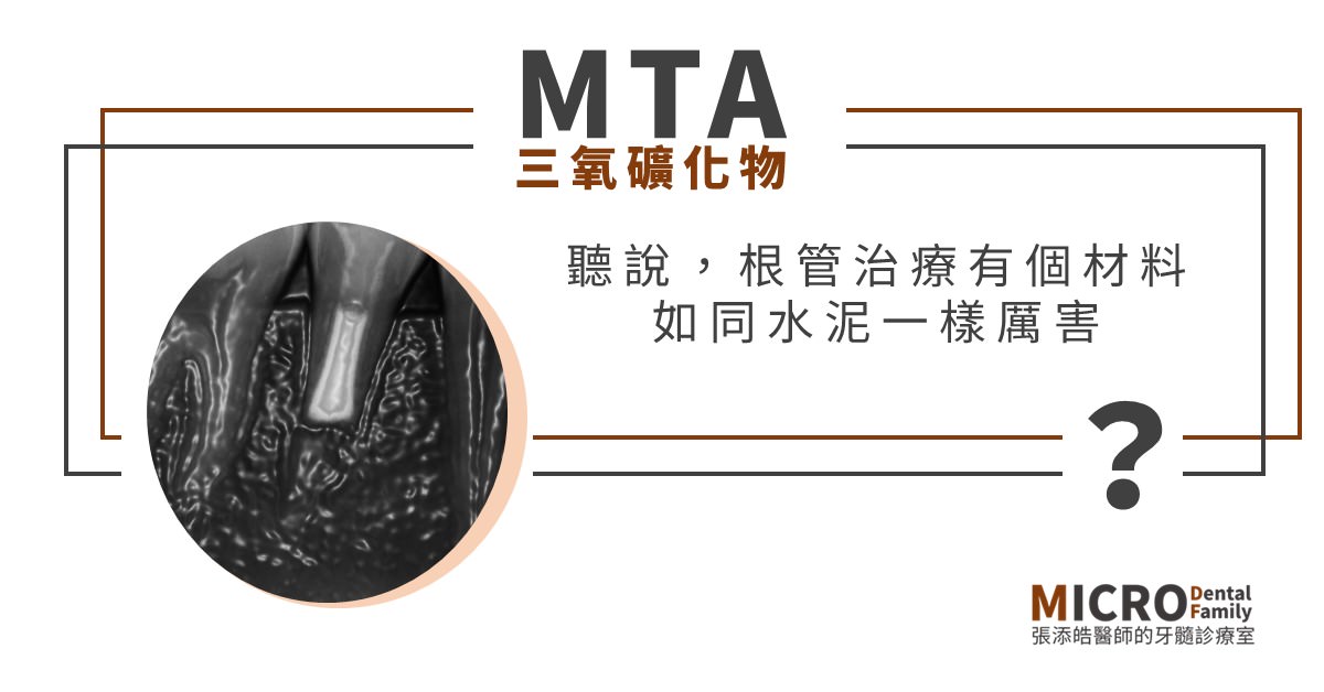 MTA三氧礦化物：聽說，根管治療有個材料如同水泥一樣厲害？生物陶瓷又是什麼？(2021/07更新)