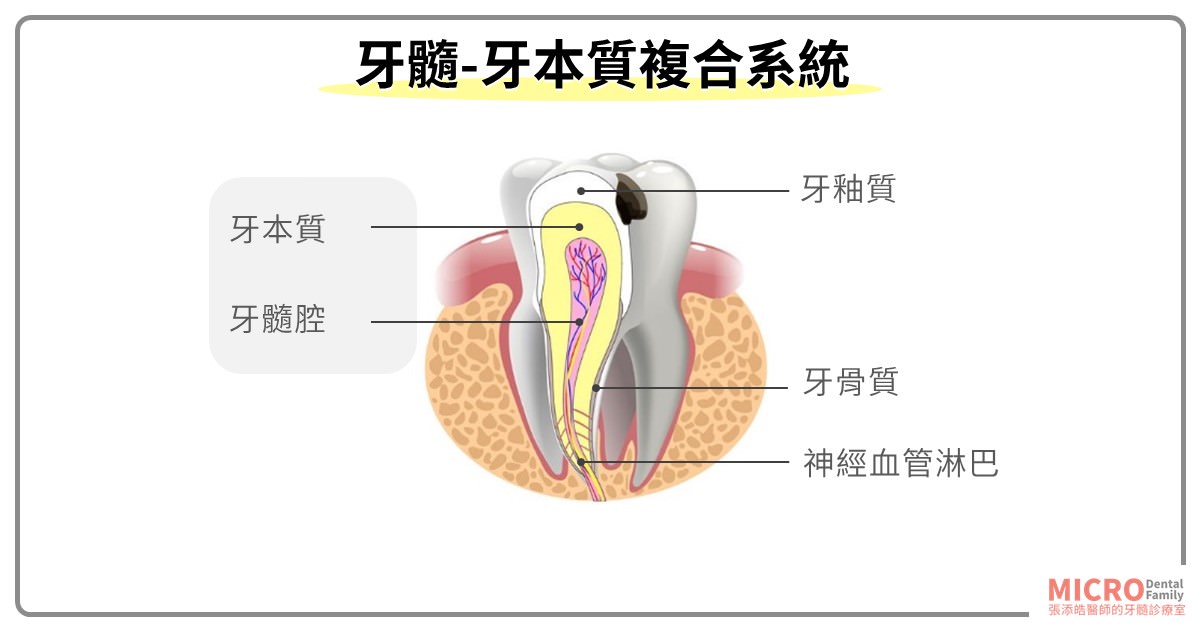為什麼補完蛀牙後，還是可能會要根管治療、抽神經、顯微根管治療呢？病人問到爛的9個問題！(2023/10更新)