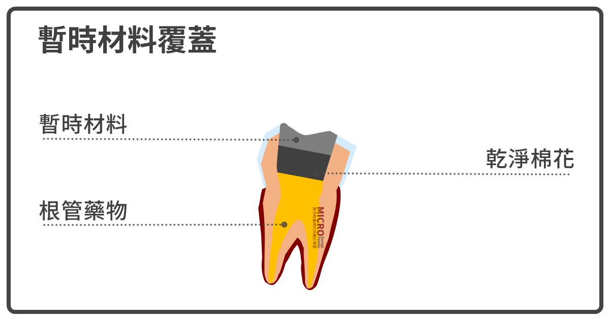 牙髓病健康照護手冊