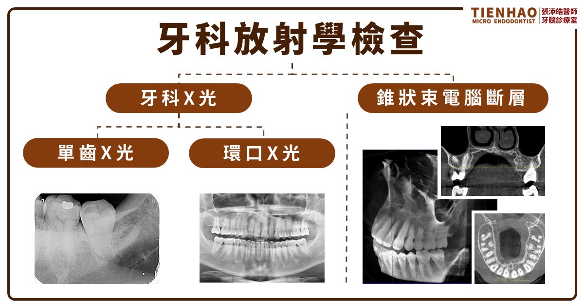 牙科放射線學檢查