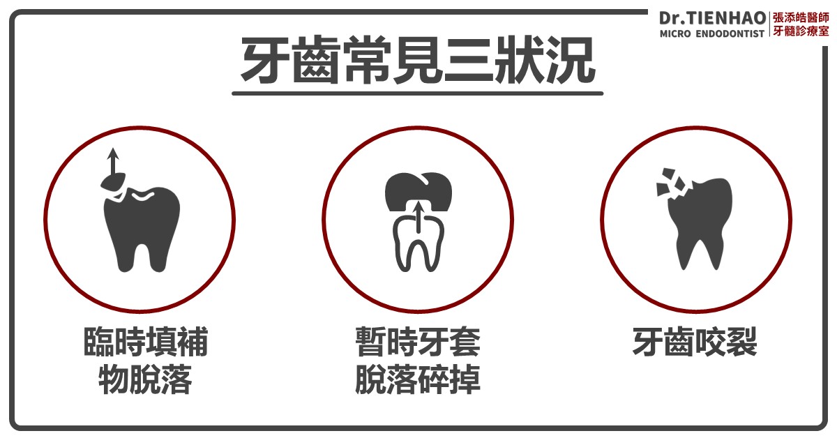 根管治療後的牙齒，咬裂的情況最常見到的是下面三個慘況