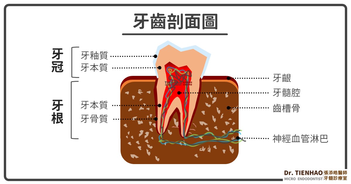 原來牙齒裡面也會結石呀！你聽過牙髓石嗎？與根管鈣化有什麼關係？(2022/02更新)
