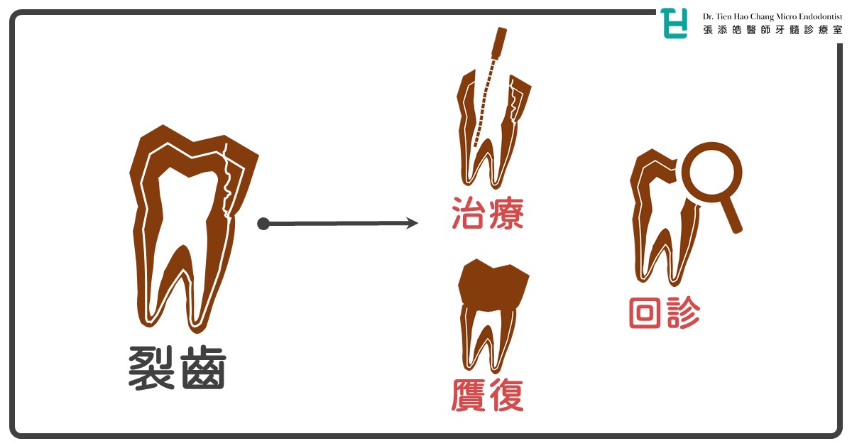 牙裂裂齒裂牙