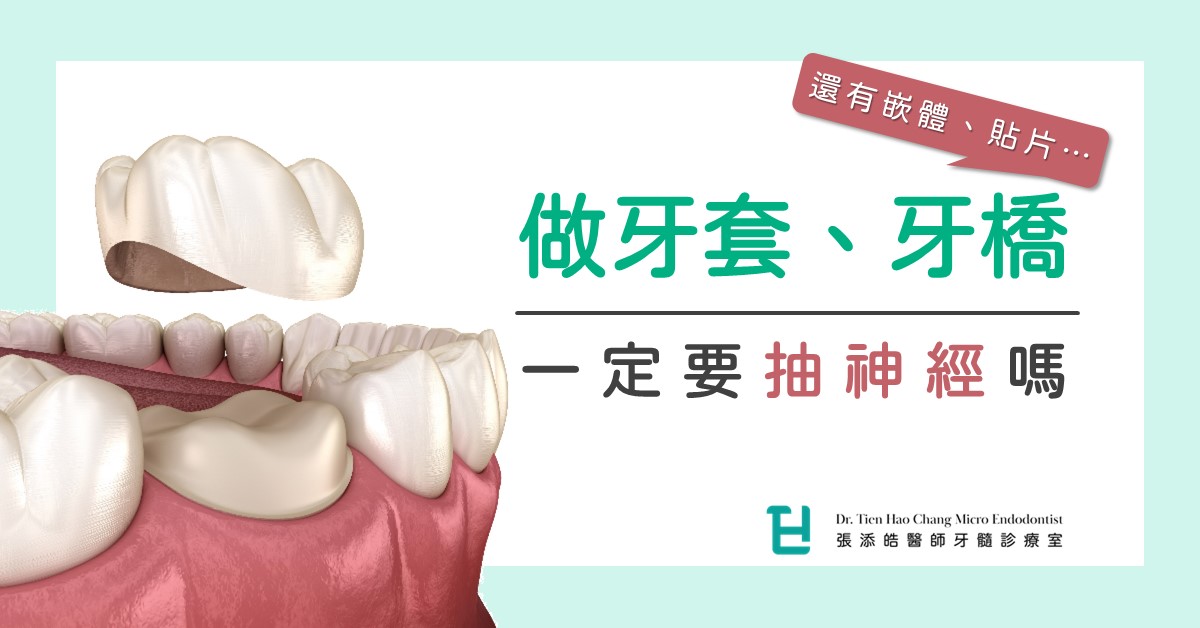 做牙套、牙橋、假牙，一定要先抽神經、根管治療、顯微根管治療嗎？3階段前中後告訴你，醫師在想什麼？！(2023/02更新)