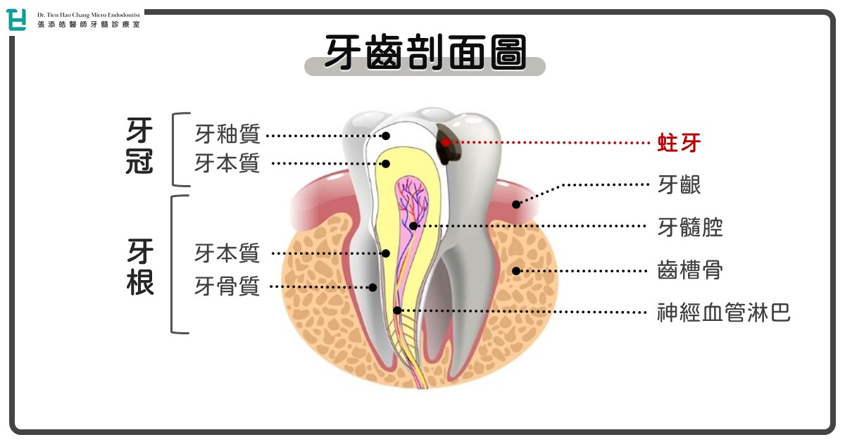 牙齒剖面圖牙髓根管