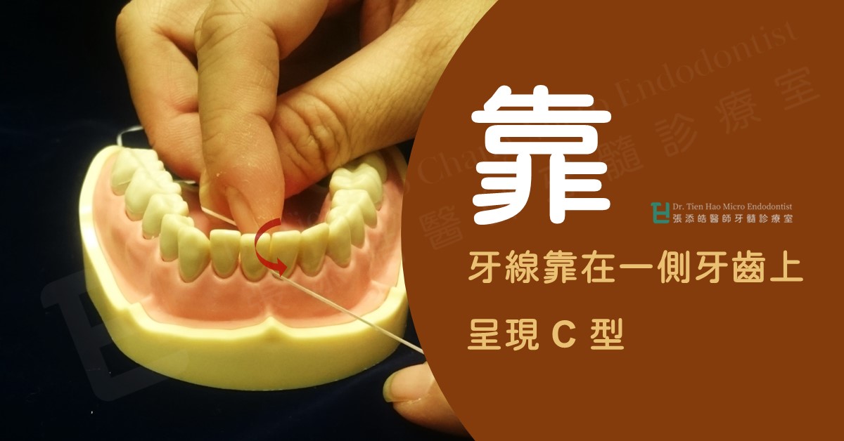 牙線接觸牙縫口訣：過、靠、刮