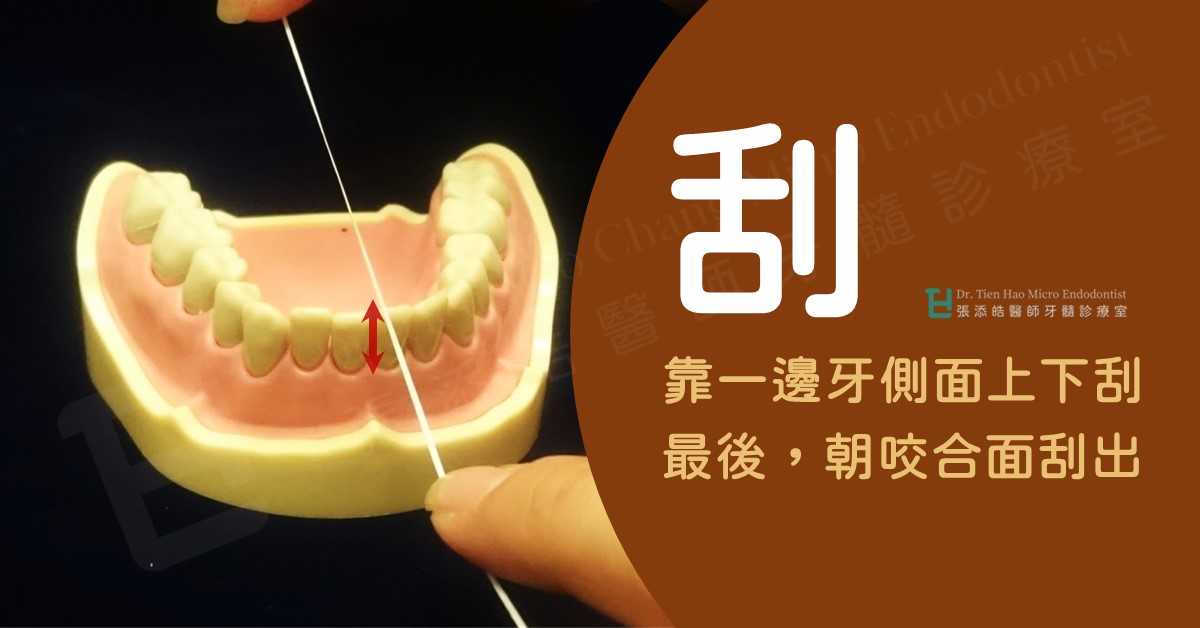 牙線接觸牙縫口訣：過、靠、刮