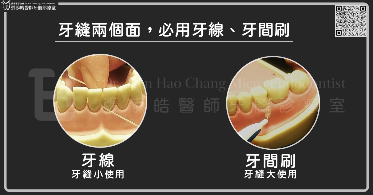 預防牙縫蛀牙，必用牙線、牙間刷新竹顯微根管治療張添皓牙縫蛀牙