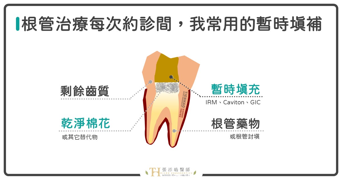 根管治療中，暫時填補物脫落該怎麼辦