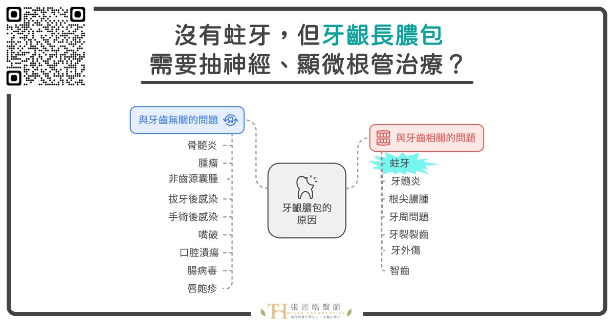 為什麼我沒有蛀牙，但牙齦長膿包，需要抽神經、根管治療、顯微根管治療？