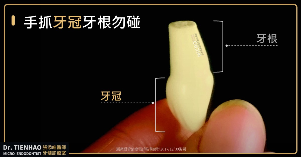 牙齒撞掉落，恆牙外傷、牙脫落。預防及緊急處理，之前中後三妙計。快、放、回三口訣【張添皓醫師顯微根管治療特診】