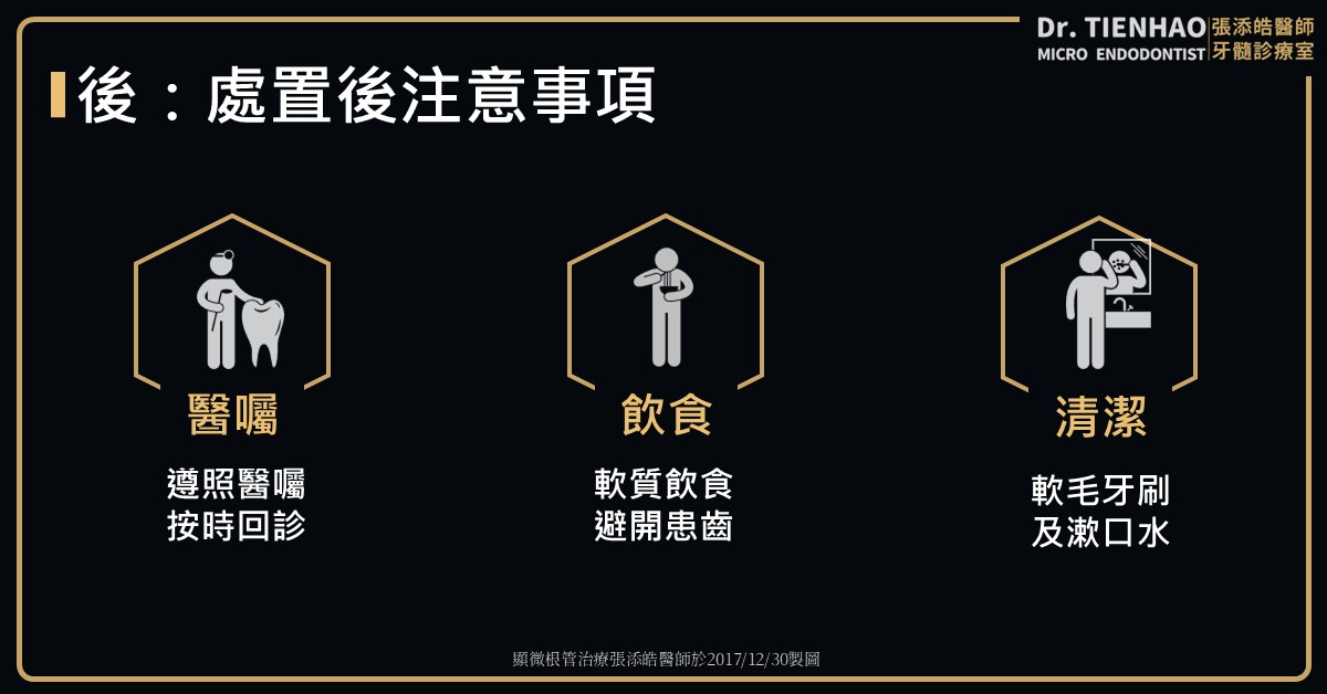 牙齒撞掉落，恆牙外傷、牙脫落。預防及緊急處理，之前中後三妙計。快、放、回三口訣【張添皓醫師顯微根管治療特診】