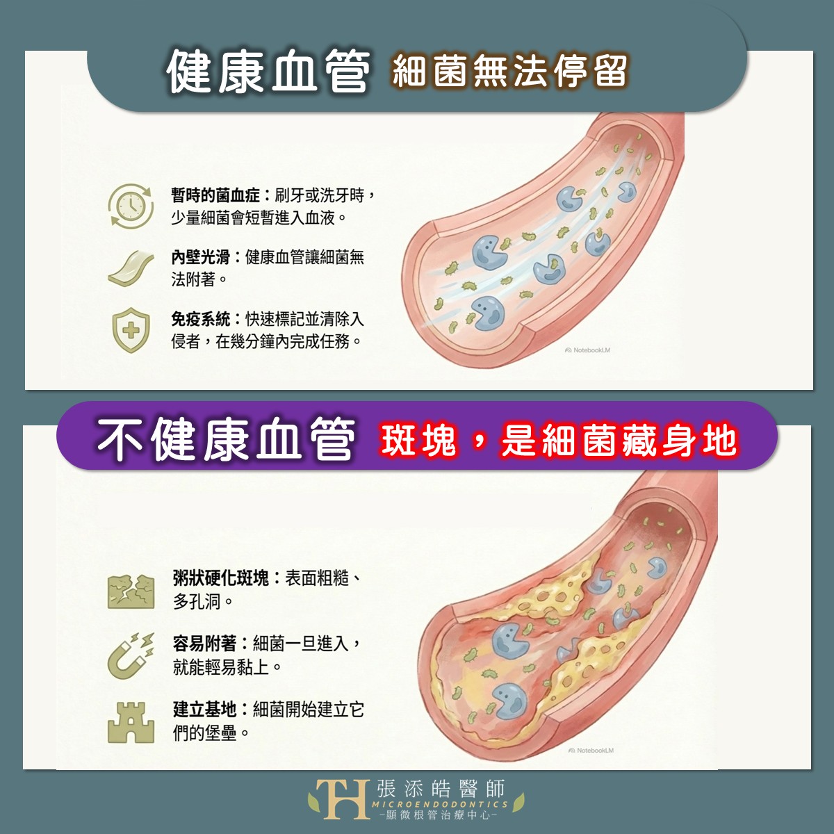 刷牙、牙齒治療會讓口腔牙齒細菌跑進血液嗎？會不會害我心臟病？