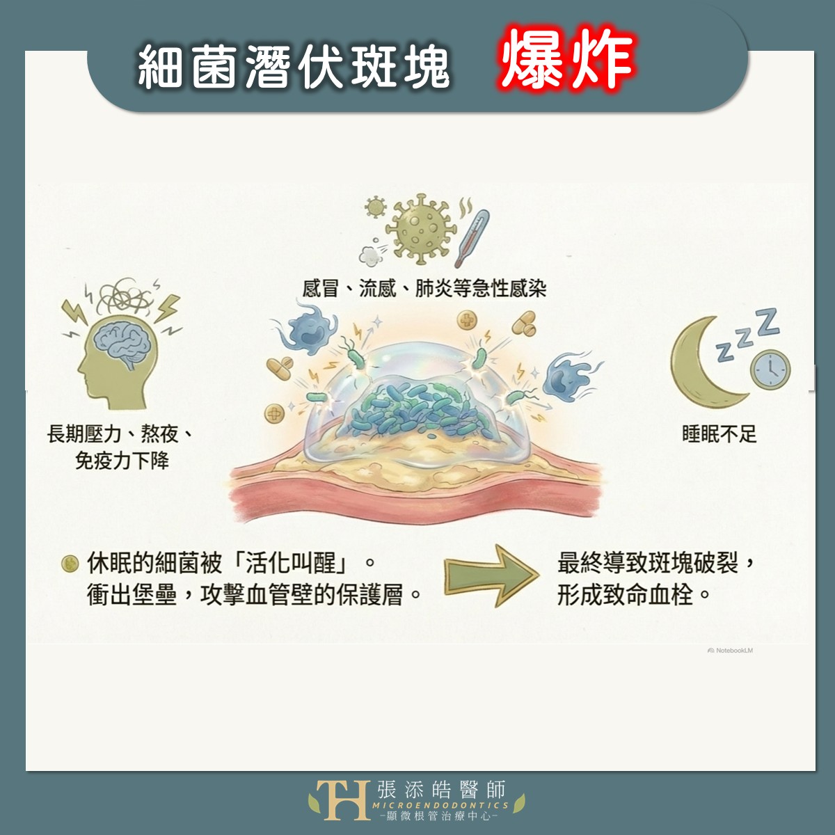 刷牙、牙齒治療會讓口腔牙齒細菌跑進血液嗎？會不會害我心臟病？