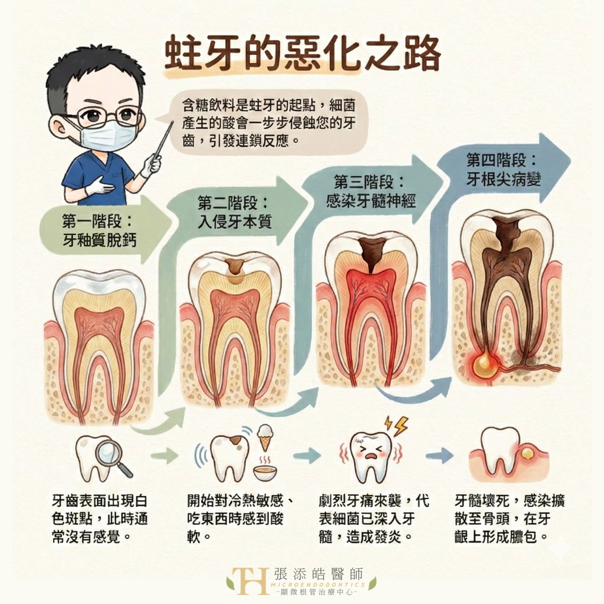 蛀牙惡化四步驟