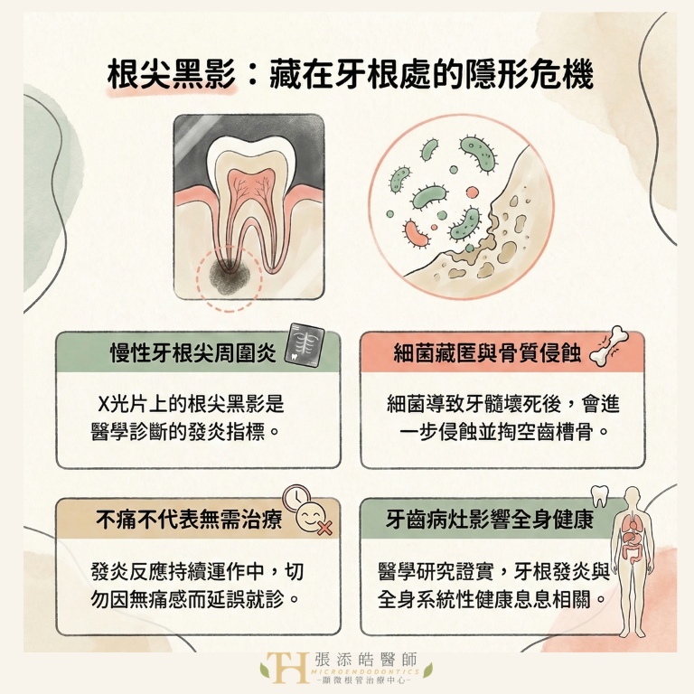 牙齒不痛就沒事？X 光下的黑影，是無聲的警訊。顯微根管治療張添皓