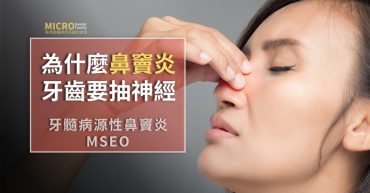 牙髓鼻竇炎MESO