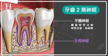 根管治療後，仍牙齒痛的常見4原因，抽完神經還痛？2