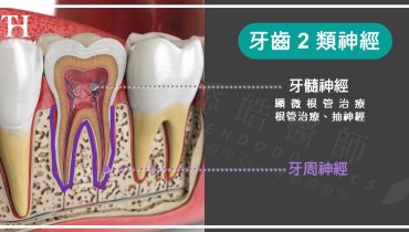 根管治療後，仍牙齒痛的常見4原因，抽完神經還痛？2