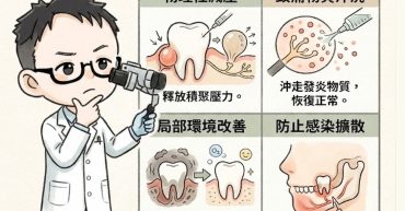牙齦膿包刺破後，為什麼馬上就不痛了？牙髓病專科醫師揭密短暫不痛背後的 4 大危險真相1